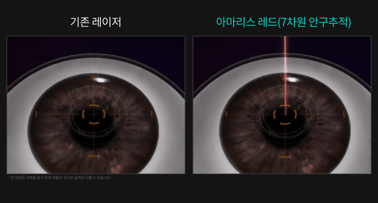 7차원 안구추적장치 (7D Eye Tracking)