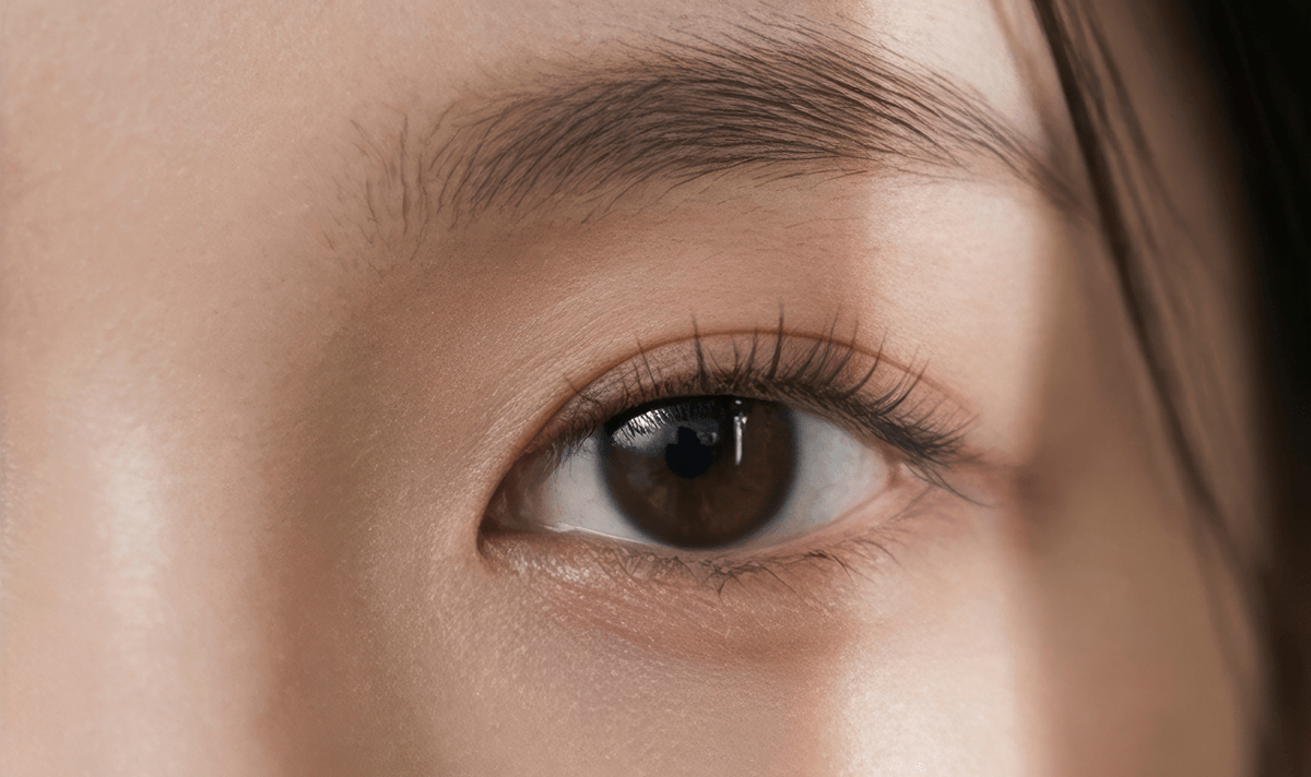 각막이 얇아 안전한 잔여 각막 확보가 ,[object Object],최우선인 분
