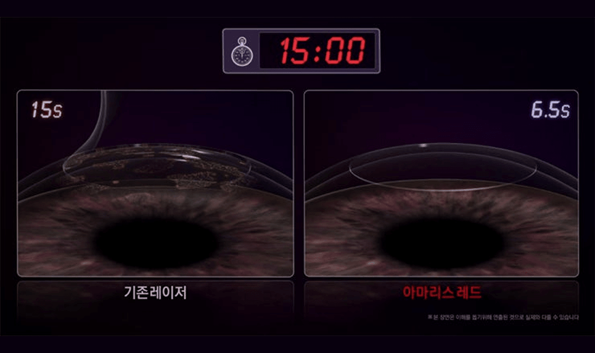 초고속 1050Hz, 압도적인 조사 속도